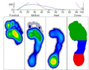 Biomechanical Pressure Plate