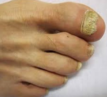 Close-up of foot with clean nails