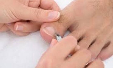 Conservative Treatment