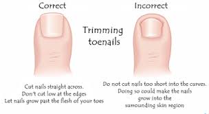 Correct and Incorrect Trimming Toenails