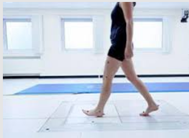 Gait Analysis