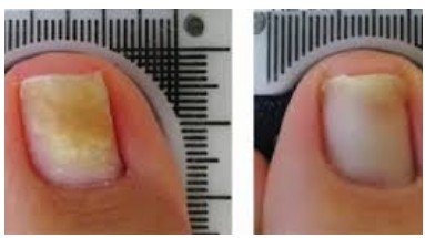 Before and After Treatment 3